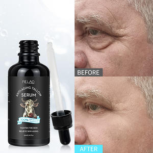 Sérum à base de suif pour le visage des hommes Traitement anti-rides et raffermissant Hydratation profonde Soin de la peau naturel pour hommes Sérum anti-âge - Product Image 1