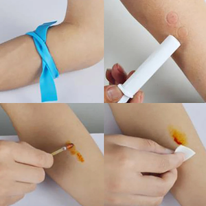 Piqûre d'insecte d'abeille de <span class=keywords><strong>lit</strong></span> naturel soulage la douleur Outil d'aspiration de ravageur d'urgence de sécurité extérieure - Product Image 6