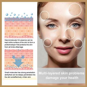 OBM OEM usine prix de gros blanchissant coréen soins de la peau <span class=keywords><strong>Toner</strong></span> pour le visage hydratation riz <span class=keywords><strong>Toner</strong></span> eau nicotinamide pour peau sèche - Product Image 4