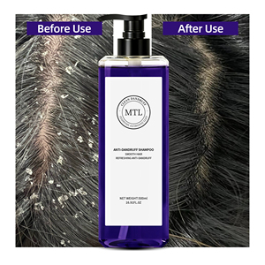 Shampooing Antichute Naturel aux Herbes 500ml – Vente en Gros – Purifie le Cuir Chevelu Gras – Soulagement Professionnel pour Cheveux Secs, Démangeaisons et Desquamation – Soin Capillaire – Marque Privée OEM - Product Image 2