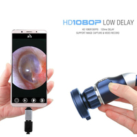 Système de caméra endoscopique pour arthroscopie et sinusoscopie Camjoy Medical FHD 1080p avec port USB, certifié CE