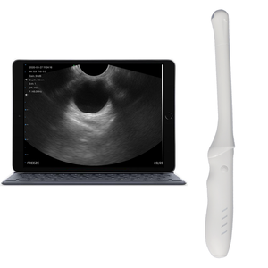 T8 초음파 드 마노 변환기 de 초음파 inalambrico convexo 질식 매트릭스 선형 - Product Image 4