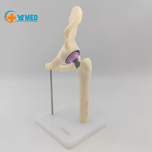 Modello di Sostituzione dell'Anca in Scala Ridotta per Comunicazione Clinica tra Ortopedisti e Pazienti - Product Image 4