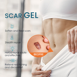 Vente en gros organique vergetures taches de rousseur pigmentation acné élimination des cicatrices crème gel pour les vieilles cicatrices - Product Image 3