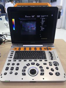 Ecógrafo Doppler Color Portátil de Grado Profesional Dawei DW-P60 con Imágenes de Elastografía para Diagnóstico Veterinario - Product Image 1