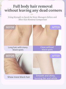 Rasoir électrique 5 en 1 pour femmes, rasoir pour femmes, tondeuse pour poils du corps, pour les aisselles, le bikini, les bras, les jambes, le visage, la <span class=keywords><strong>moustache</strong></span>, portable, indolore - Product Image 6