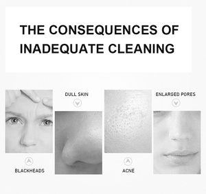 Soins de La Peau du visage Électrique Nettoyeur de Pores Machine D'<span class=keywords><strong>extraction</strong></span> de Points Noirs Sous Vide - Product Image 5