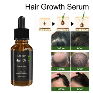 น้ำมัน<span class=keywords><strong>ผม</strong></span>ป้องกันการสูญเสียเส้นผมซ่อมแซมหนังศีรษะนุ่มชุ่มชื้นสำหรับน้ำมันเจริญเติบโตของเส้นผม - Product Image 4