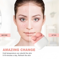 Rouleau facial orthopédique personnalisé avec logo pour hommes et femmes, rouleau de glace double face pour les soins de la peau du visage et des yeux avec étui, masseur pour l'auto-soin