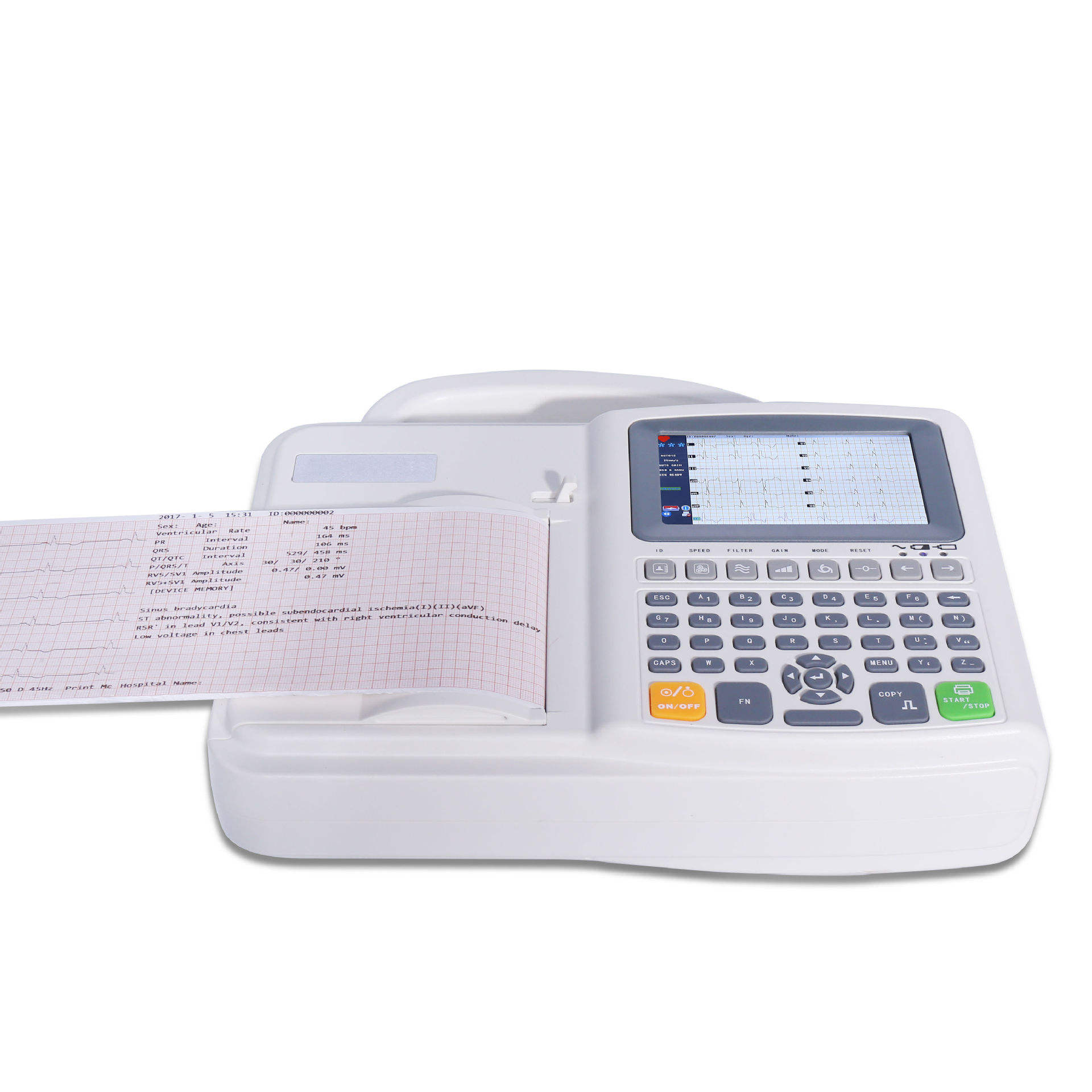 เครื่องตรวจคลื่นไฟฟ้าหัวใจ