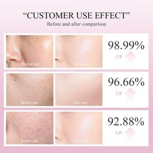 เซรั่มบำรุงผิวหน้าสูตรเฉพาะ OEM พร้อมโลโก้ส่วนตัว ไฮยาลูรอน วิตามินซี เรตินอล คอลลาเจนจากเมือกหอยทาก ไนอะซินาไมด์ - Product Image 5