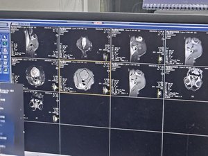Système d'imagerie médicale radiologique pour animaux de compagnie EUR VET, réutilisable, en forme de C, 0,35T, pour scanner IRM en milieu hospitalier - Product Image 4