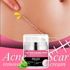 OEM ODM crème biologique naturelle pour femmes, crème de réparation de la peau pour l'élimination des vergetures après accouchement