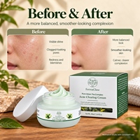 Crème hydratante équilibrante et apaisante au thé vert fermenté pour le soin de la peau, anti-acné, régulatrice de sébum, purifiante des pores et anti-imperfections