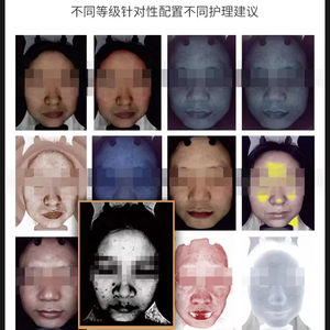 Escáner Dérmico Estético Clínico, Instrumento de Diagnóstico Facial Completo, Prueba de Humedad Facial, Análisis Facial, Máquina de Análisis de Piel 3D - Product Image 6