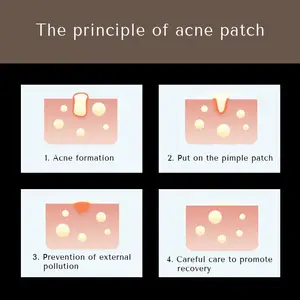Korea Oem Beauty Patch For Acne Stars And Hearts Pimple Patch Acne Morning And Night