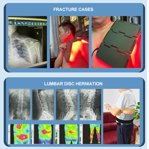 Nouvelle invention équipement de réadaptation du genou arthrite infrarouge soulagement de la douleur articulaire Hydrops dispositif de gestion de la douleur télécommandé - Product Image 3