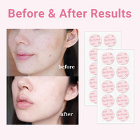 Offre Spéciale : Patchs Hydrocolloïdes Personnalisables à l'Acide Salicylique pour l'Acné et les Boutons, Traitement Localisé Anti-Imperfections et Contrôle du Sébum