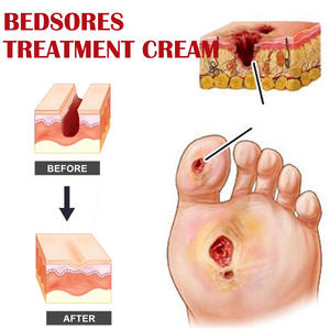 Ultimo Arrivo: Unguento per il <span class=keywords><strong>Trattamento</strong></span> Rapido delle Piaghe <span class=keywords><strong>da</strong></span> <span class=keywords><strong>Decubito</strong></span>, Crema per la Cura delle Ferite, Crema per la Cura del Corpo 20g - Product Image 5