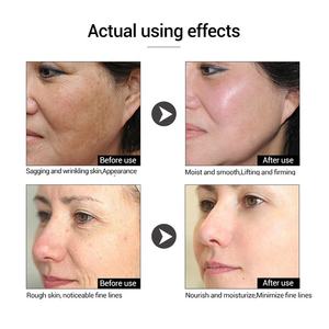 The ordinary — sérum Anti-vieillissement pour la peau, produit cosmétique, Anti-rides, contre les ridules, et les taches d'âge, raffermissant, Six peptides - Product Image 4