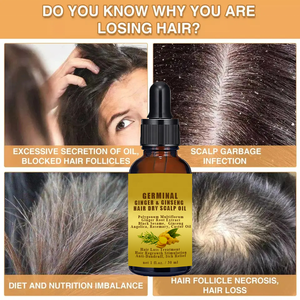 Trattamento Anticaduta e Antiforfora, Siero Germogliante allo Zenzero e Ginseng per 7 Giorni, Olio Nutriente per Massaggio del Cuoio Capelluto e Ricrescita dei Capelli - Product Image 2