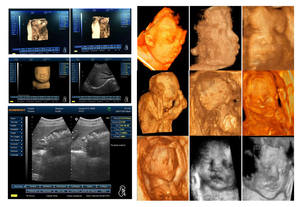 BW mesin ultrasonik portabel, mesin dasar <span class=keywords><strong>Laptop</strong></span> <span class=keywords><strong>3D</strong></span> BW mesin pemindai <span class=keywords><strong>Ultrasound</strong></span> - Product Image 2