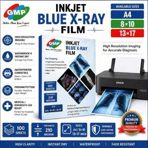 Película de Rayos X Médica de Inyección de Tinta Azul de Grado Comercial, 100 Hojas, Película de Imagenología Impermeable para Impresión Clara de Imágenes Diagnósticas - Product Image 1