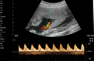 Escáner de Ultrasonido Portátil <span class=keywords><strong>5D</strong></span> con Sonda 3 en 1 C10rl - Product Image 4