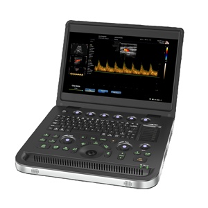 Système d'échographie Doppler couleur portable et d'imagerie diagnostique très demandé pour usage vétérinaire - Product Image 1