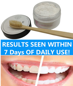 Polvere sbiancante per <span class=keywords><strong>denti</strong></span> a marchio privato con NHA per la <span class=keywords><strong>pulizia</strong></span> <span class=keywords><strong>e</strong></span> lo <span class=keywords><strong>sbiancamento</strong></span> dei <span class=keywords><strong>denti</strong></span> - Product Image 4