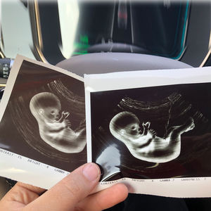 Papier d'imprimante vidéo haute brillance papier échographie pas cher 110hg UP 110HG rouleau de papier thermique pour imprimante vidéo Sony - Product Image 5