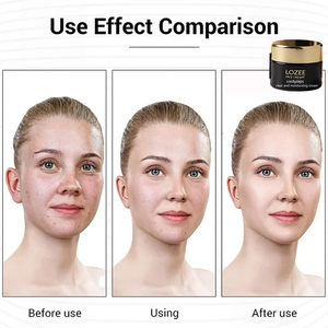 Crème éclaircissante anti-taches LOZEE, atténue le chloasma, les taches solaires, les taches de vieillesse, éclaircit le teint, hydrate, répare la peau - Product Image 2