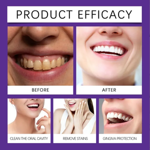 Limpia y protege suavemente los dientes para una frescura duradera y elimina las manchas y los dientes amarillos Polvo de belleza púrpura - Product Image 5
