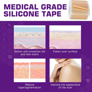 ETRUN ALISA Bande de <span class=keywords><strong>cicatrice</strong></span> en gel de silicone Marque privée Enlèvement de gel de silicone Ancien et nouveau pansement cicatriciel <span class=keywords><strong>efficace</strong></span> <span class=keywords><strong>Anti</strong></span>-<span class=keywords><strong>cicatrice</strong></span> - Product Image 2
