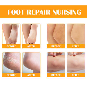 ELAIMEI vente en gros 100ml adoucissant les callosités élimine les peaux mortes pour un gommage instantané des pieds avec de l'huile d'orange pour les peaux sèches et fissurées - Product Image 2