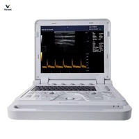 Échographe Doppler B-mode convivial avec stockage pour le contrôle de la gestation des animaux de ferme et les besoins quotidiens d'achats en gros.