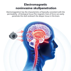 Appareil TMS médical pour le <span class=keywords><strong>traitement</strong></span> de la dépression et de l'anxiété, dispositifs de neurofeedback avancés pour la réadaptation de la santé mentale - Product Image 3