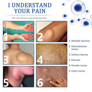 Eliminación y Alivio de Diversos Nódulos Grasos en el Cuerpo. Eliminación de masas subcutáneas. Parche de Cuidado <span class=keywords><strong>para</strong></span> el Cuidado Postoperatorio - Product Image 6
