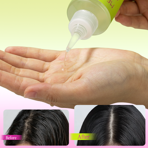 <span class=keywords><strong>น้ำ</strong></span>ยาทำความสะอาดหนังศีรษะสูตรแอปเปิ้ลไซเดอร์ไวนิเกอร์ OEM ช่วยทำความสะอาด ลดรังแค บำรุงผมให้เรียบลื่น เงางาม ปรับสมดุลค่า pH ของหนังศีรษะ - Product Image 5