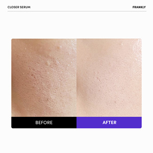 FRANKLY Closer Sérum Antienvejecimiento con Péptidos de Colágeno para una Piel Suave y Reducción de Arrugas 100 ml - Product Image 2