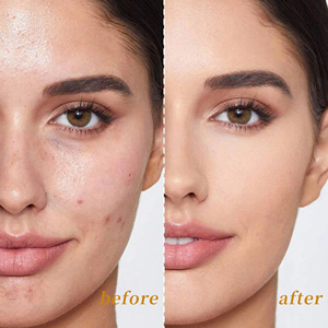 CHUSN Gel Exfoliante Enzimático Suave para Salón y Spa, Exfolia las Células Muertas, Refina la Textura y Aumenta la Hidratación - Product Image 5