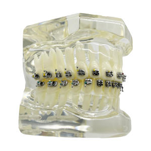 Yamei ortodontico 10000set a buon mercato tipo caldo dentale ortodontico Roth staffa Roth MBT Edgewise Wire taglio staffe (20 pz/carta) - Product Image 3