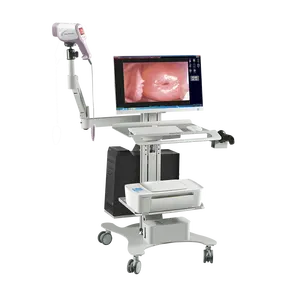 Sistema de imágenes ginecológicas de vídeo digital Hospital médico Carro de endoscopia especializado Colposcopio óptico digital