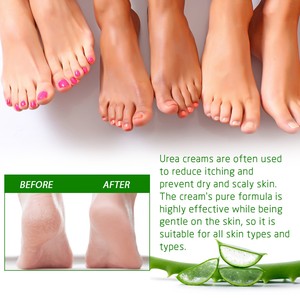 Venta al por mayor Eelhoe Tea Tree Oil <span class=keywords><strong>Aloe</strong></span> <span class=keywords><strong>Vera</strong></span> piel seca hidratante eliminación áspera Crema <span class=keywords><strong>para</strong></span> pies <span class=keywords><strong>para</strong></span> <span class=keywords><strong>talones</strong></span> <span class=keywords><strong>agrietados</strong></span> - Product Image 5