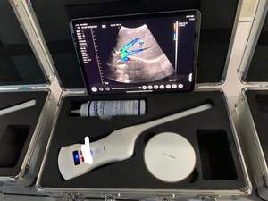 Alta Qualidade 192 Elementos Handheld Cor <span class=keywords><strong>Doppler</strong></span> Wifi & Usb Ultrassom <span class=keywords><strong>Transvaginal</strong></span> <span class=keywords><strong>Probe</strong></span> Konted C10QT - Product Image 2