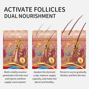 Aceite para el Crecimiento del Cabello con Biotina y Colágeno Orgánico de Marca Privada para Cuero Cabelludo Sensible - Cuidado Nutritivo y Reparación Capilar - Product Image 5