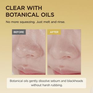 SKIN1004 Huile nettoyante légère à la Centella de <span class=keywords><strong>Madagascar</strong></span> 6,76 fl.oz, 200 ml |   Nettoyant doux à l'huile pour le visage, nettoyant facial coréen - Product Image 3