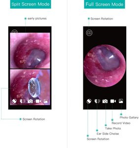 Otoscope visuel pour le nettoyage des oreilles, outil de nettoyage du cérumen avec caméra - Product Image 5