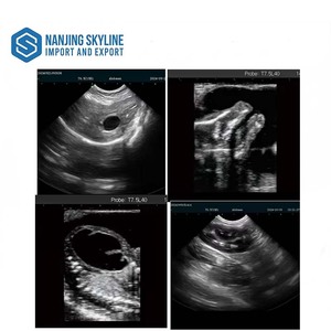 Equipo <span class=keywords><strong>de</strong></span> Diagnóstico Veterinario, Ecógrafo Veterinario Portátil para Cabras - Product Image 6