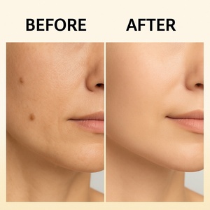 Removedor de <span class=keywords><strong>verrugas</strong></span> y acrocordones 15ml - Elimina callos, <span class=keywords><strong>verrugas</strong></span>, bultos y acrocordones de la piel - Product Image 4